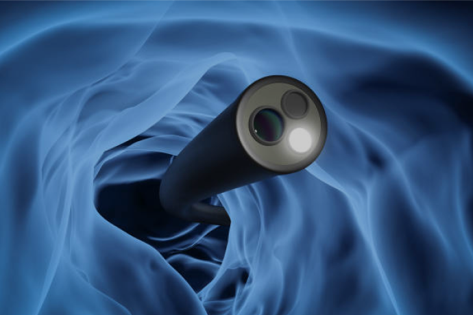 達文西微創胸腔鏡手術