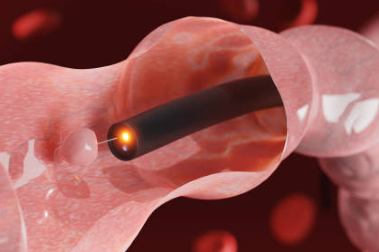 偏愛高溫熱湯、熱飲又偏好吃「這類食物」，具醫學研究：罹食道癌風險較一般人高